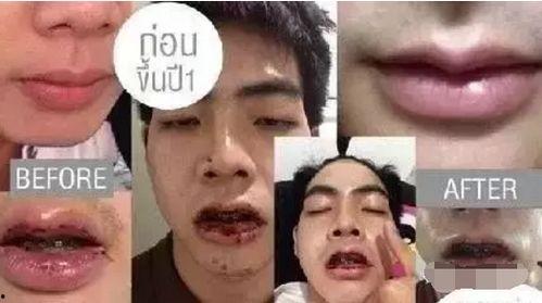 整容男网红吃瓜事件,揭秘网络红人背后的真相与争议