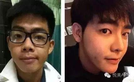 整容男网红吃瓜事件,揭秘网络红人背后的真相与争议 第3张 整容男网红吃瓜事件,揭秘网络红人背后的真相与争议 第3张